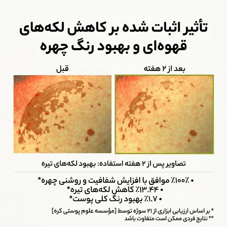 بوستر شات ویتامین سی آرنسیا ۳۰ میل